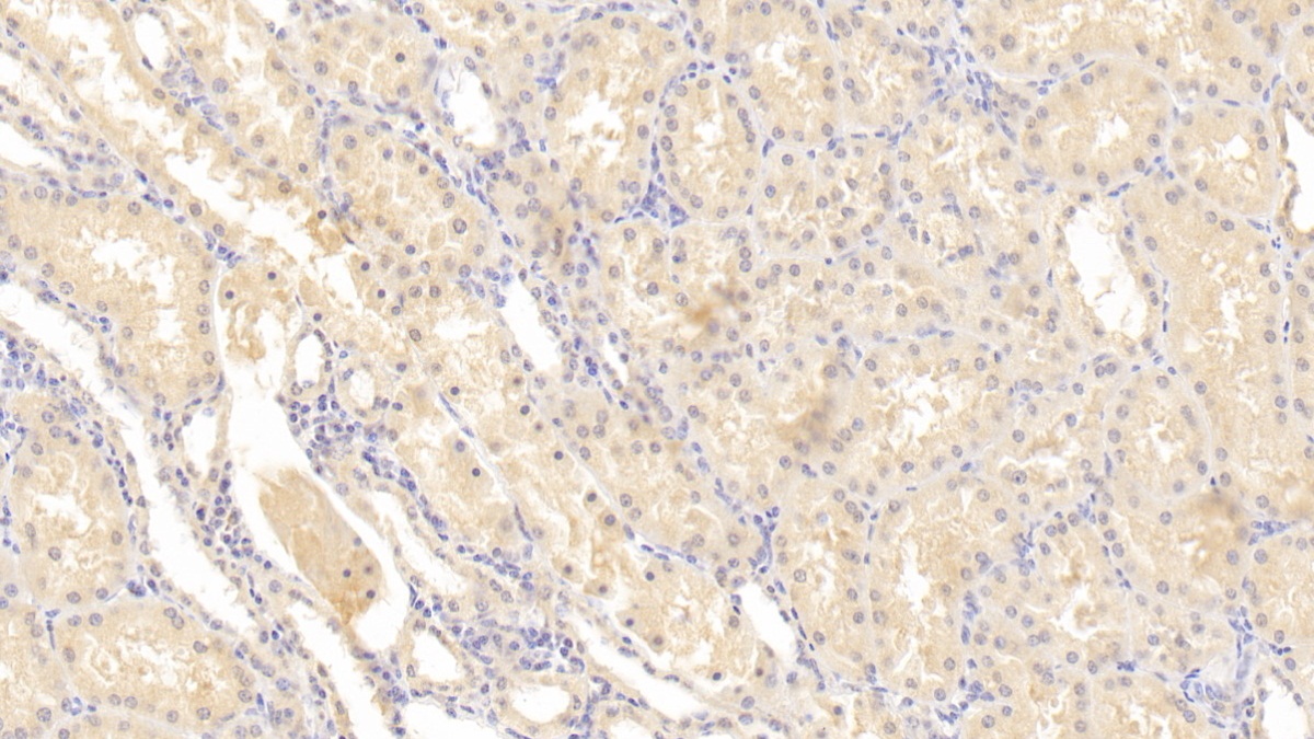 Monoclonal Antibody to Matrix Metalloproteinase 2 (MMP2)