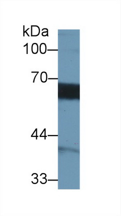 Monoclonal Antibody to Matrix Metalloproteinase 3 (MMP3)