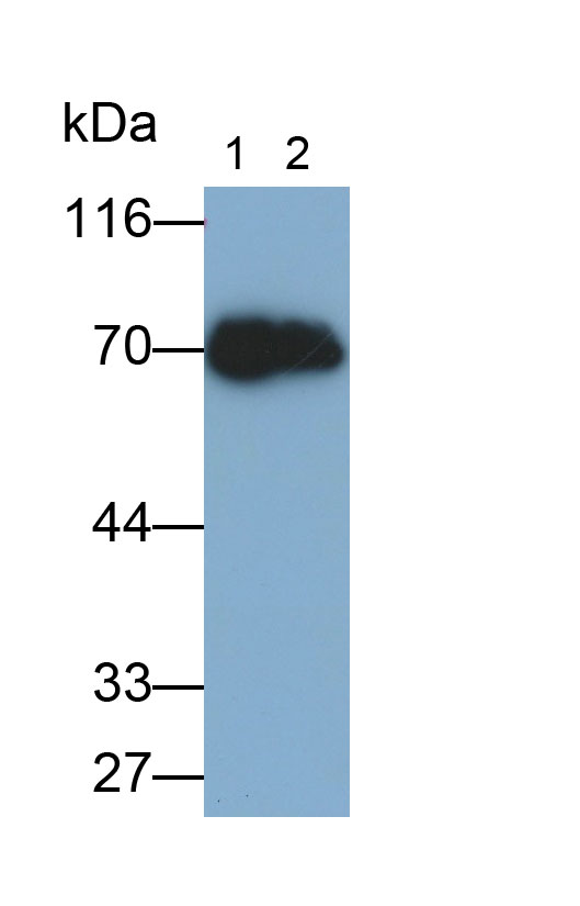 Monoclonal Antibody to Matrix Metalloproteinase 3 (MMP3)