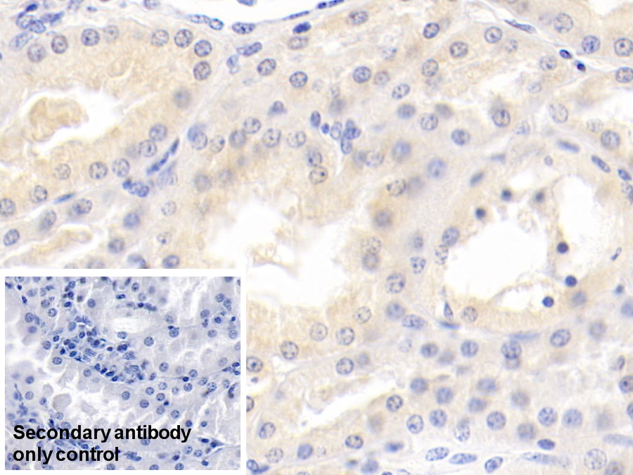 Monoclonal Antibody to Matrix Metalloproteinase 7 (MMP7)