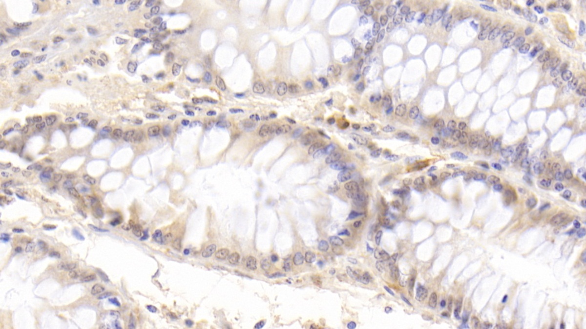 Monoclonal Antibody to Matrix Metalloproteinase 7 (MMP7)