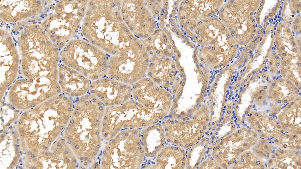 Monoclonal Antibody to Matrix Metalloproteinase 8 (MMP8)