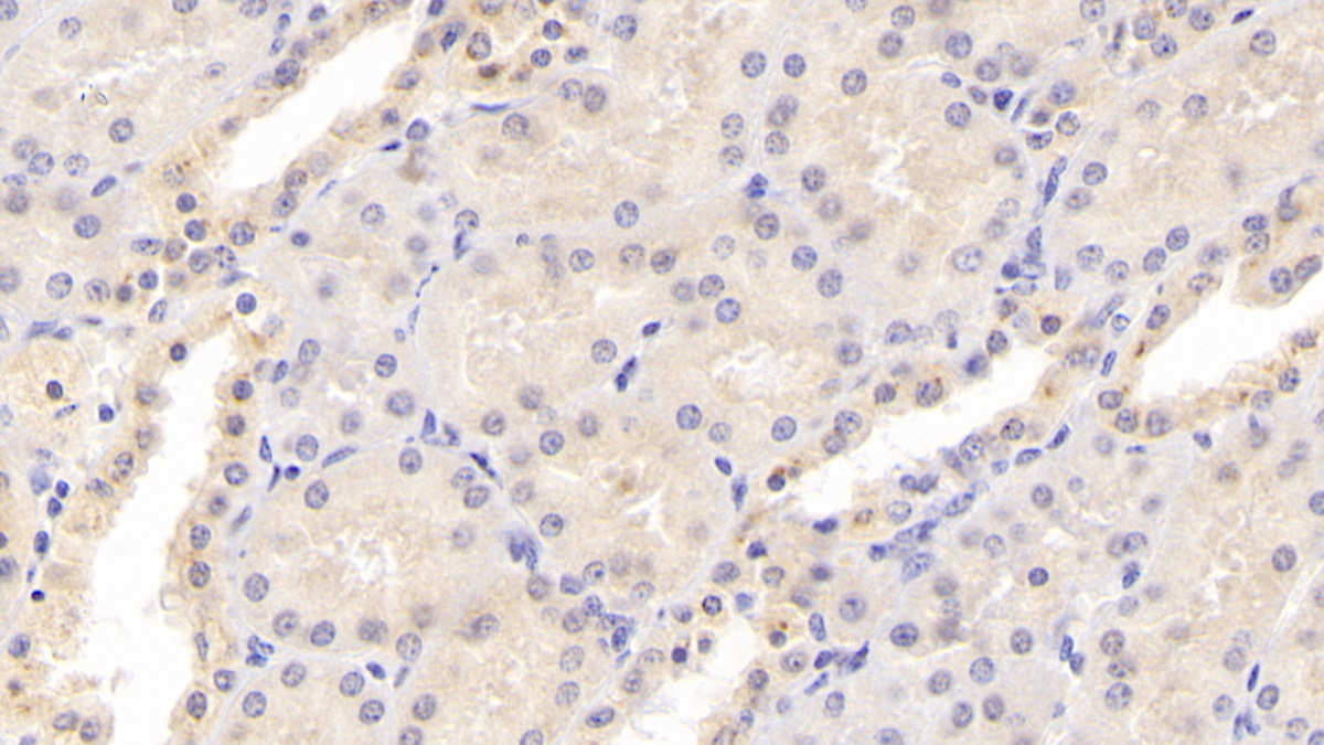 Monoclonal Antibody to Osteoprotegerin (OPG)