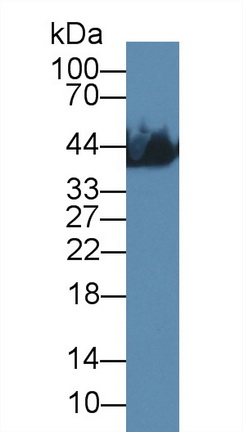 Monoclonal Antibody to Creatine Kinase, Muscle (CKM)