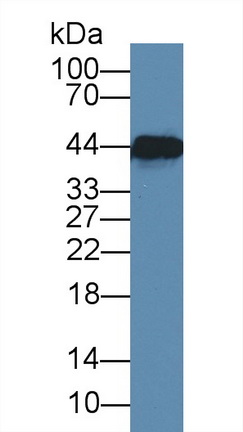 Monoclonal Antibody to Creatine Kinase, Muscle (CKM)