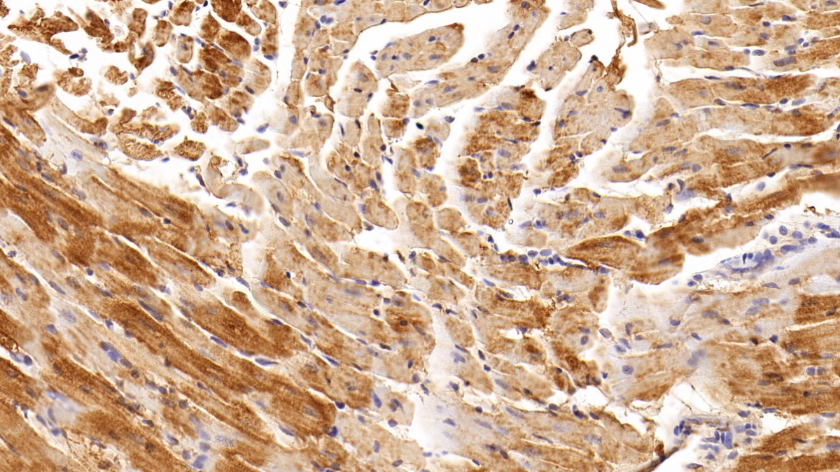 Monoclonal Antibody to Creatine Kinase, Muscle (CKM)