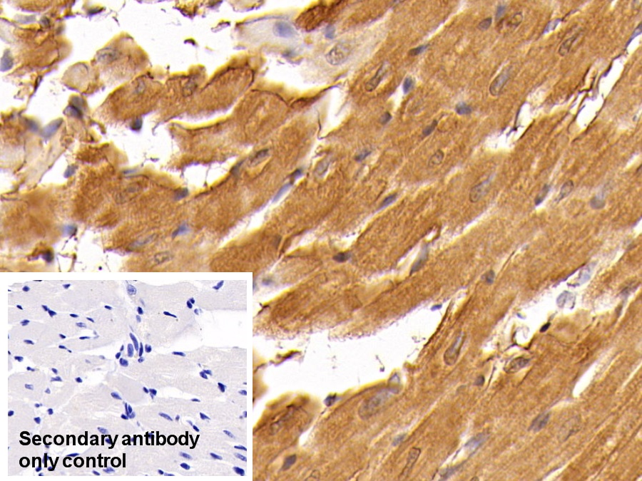 Monoclonal Antibody to Creatine Kinase, Muscle (CKM)