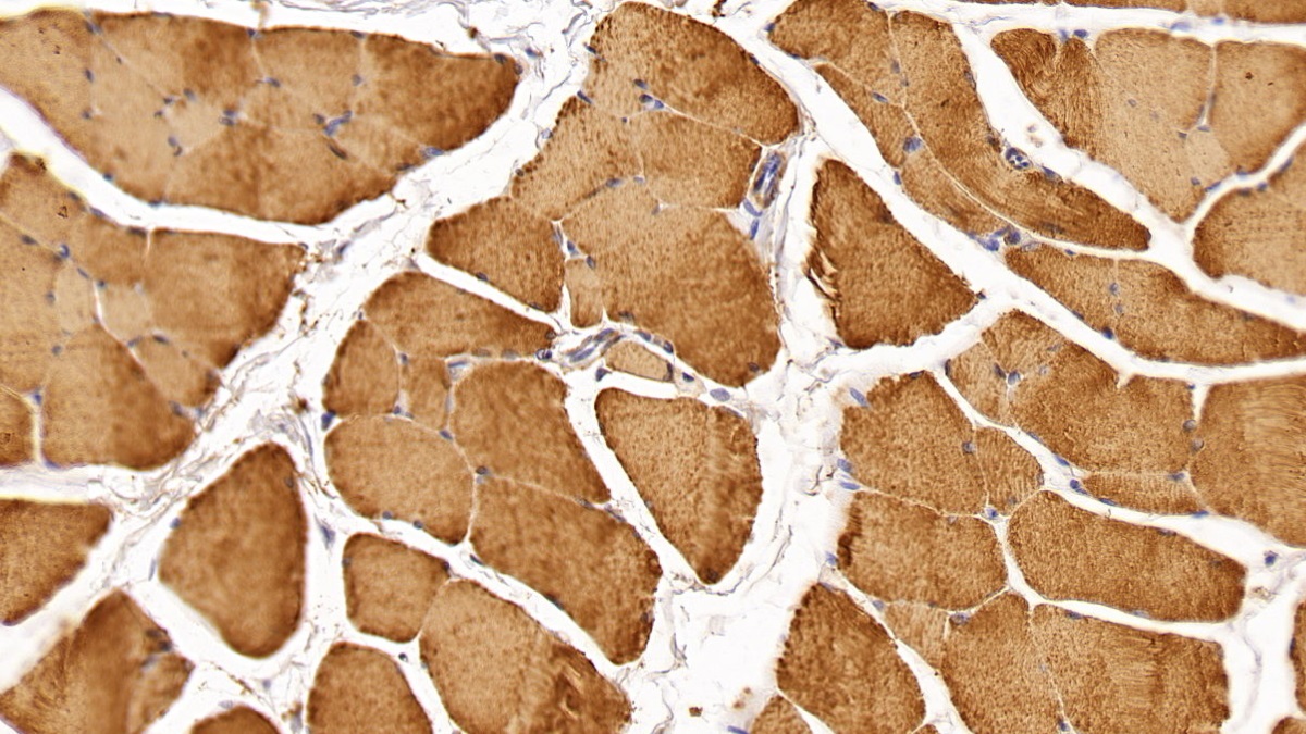 Monoclonal Antibody to Creatine Kinase, Muscle (CKM)