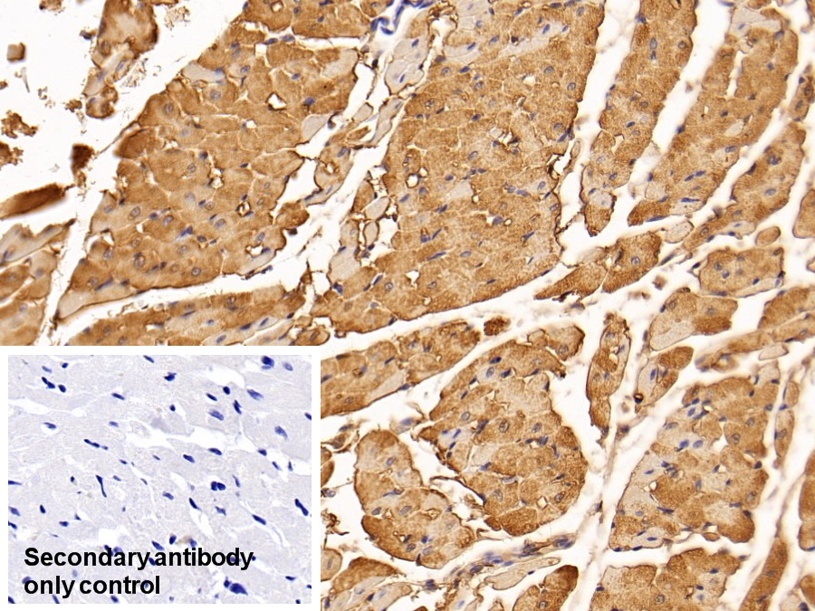 Monoclonal Antibody to Creatine Kinase, Muscle (CKM)