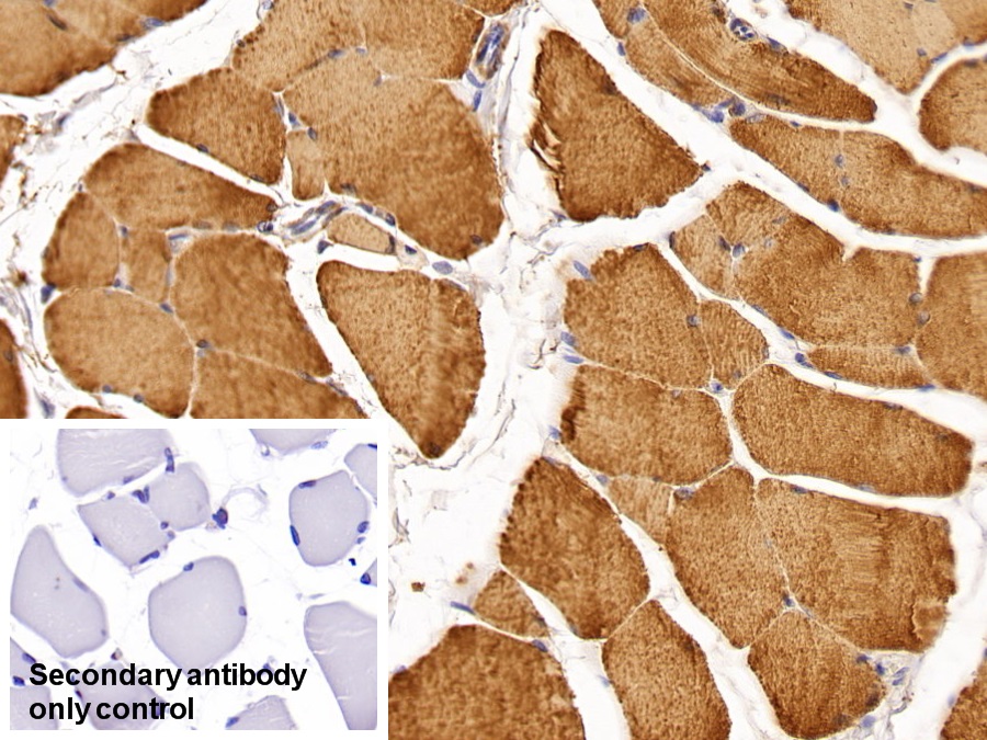 Monoclonal Antibody to Creatine Kinase, Muscle (CKM)