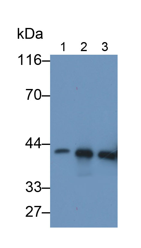 Monoclonal Antibody to Creatine Kinase, Muscle (CKM)