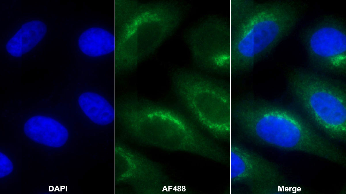 Monoclonal Antibody to Creatine Kinase, Muscle (CKM)