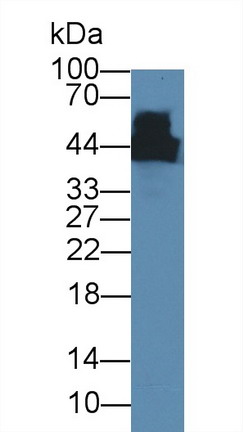 Monoclonal Antibody to Creatine Kinase, Muscle (CKM)