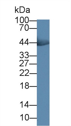 Monoclonal Antibody to Creatine Kinase, Muscle (CKM)