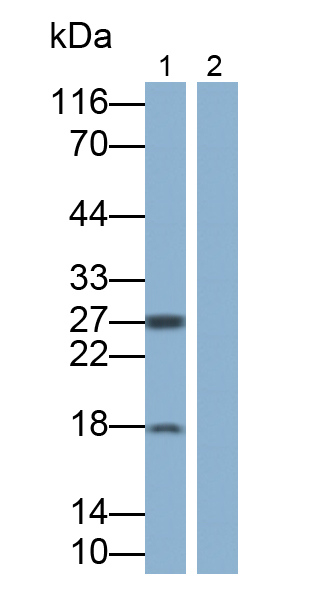 Monoclonal Antibody to Interleukin 12 (IL12)