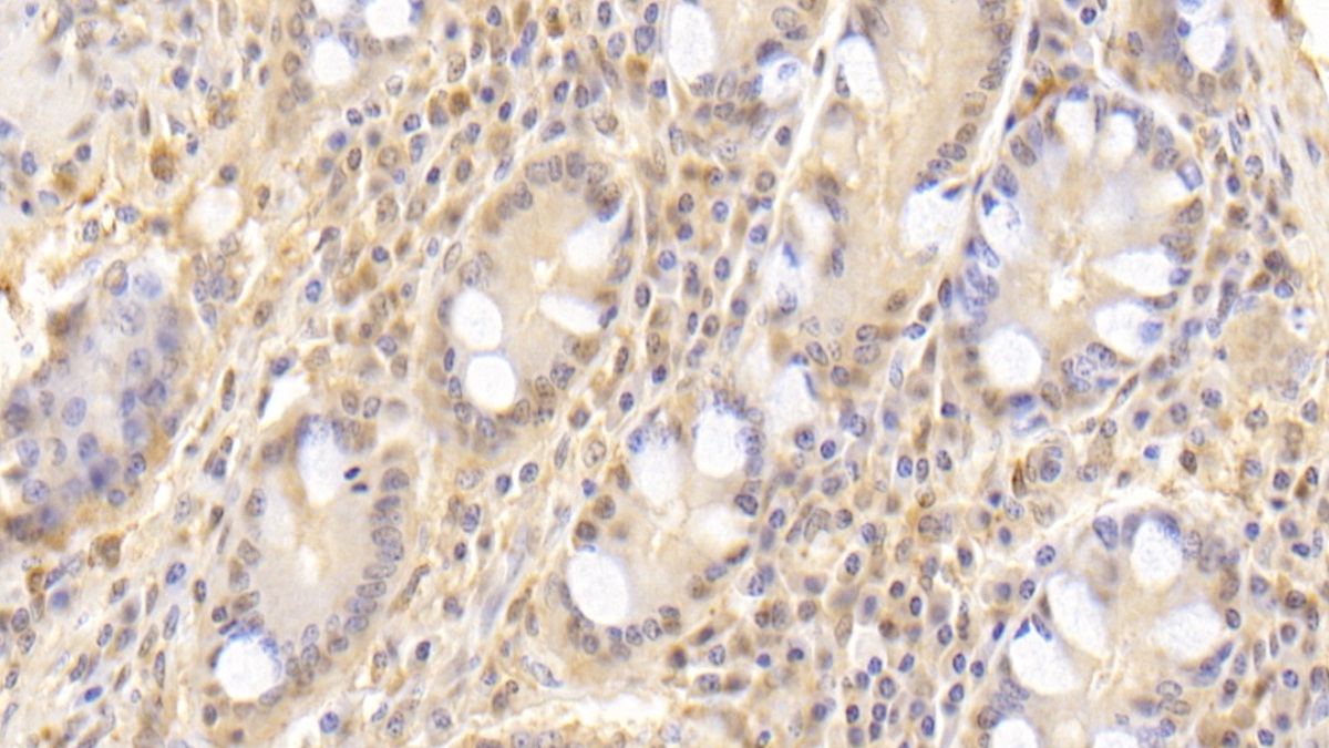 Monoclonal Antibody to Superoxide Dismutase 3, Extracellular (SOD3)