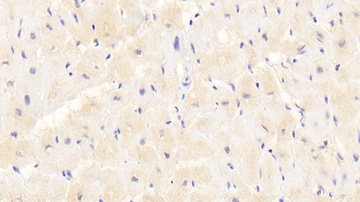 Monoclonal Antibody to Superoxide Dismutase 3, Extracellular (SOD3)