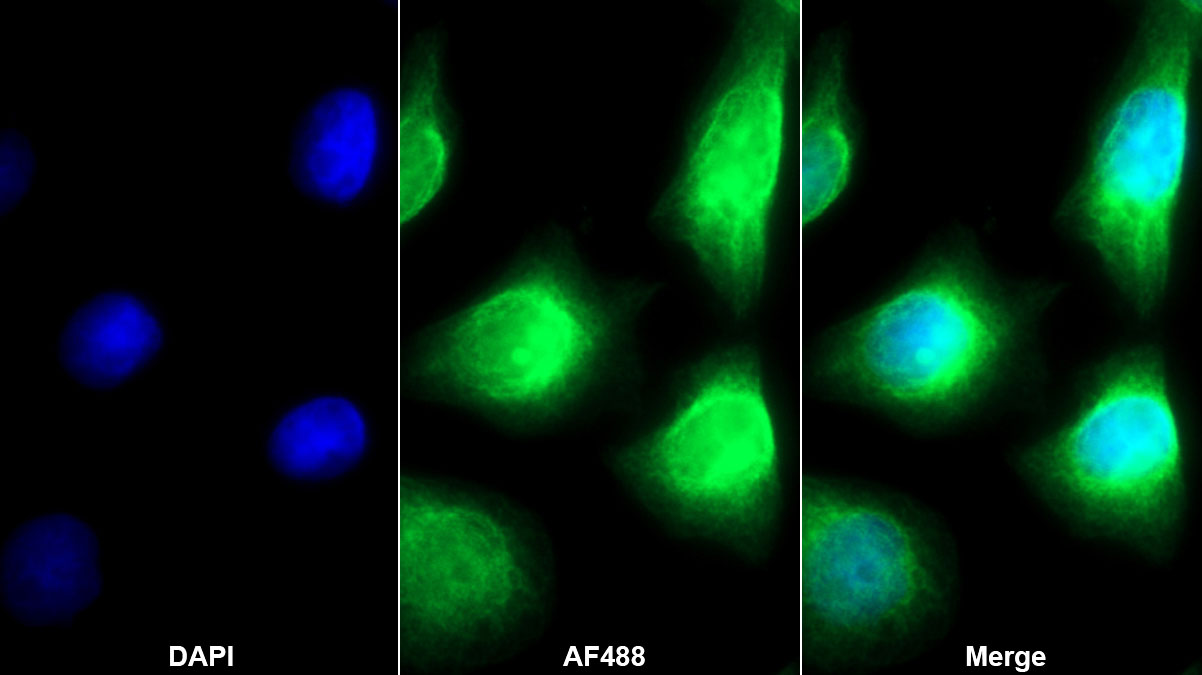 Monoclonal Antibody to Superoxide Dismutase 3, Extracellular (SOD3)