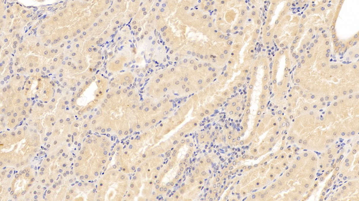 Monoclonal Antibody to Cluster Of Differentiation 40 Ligand (CD40L)