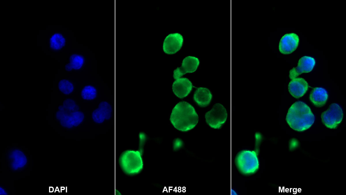 Monoclonal Antibody to Cluster Of Differentiation 40 Ligand (CD40L)