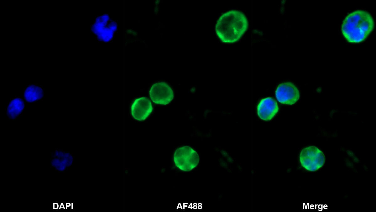 Monoclonal Antibody to Cluster Of Differentiation 40 Ligand (CD40L)