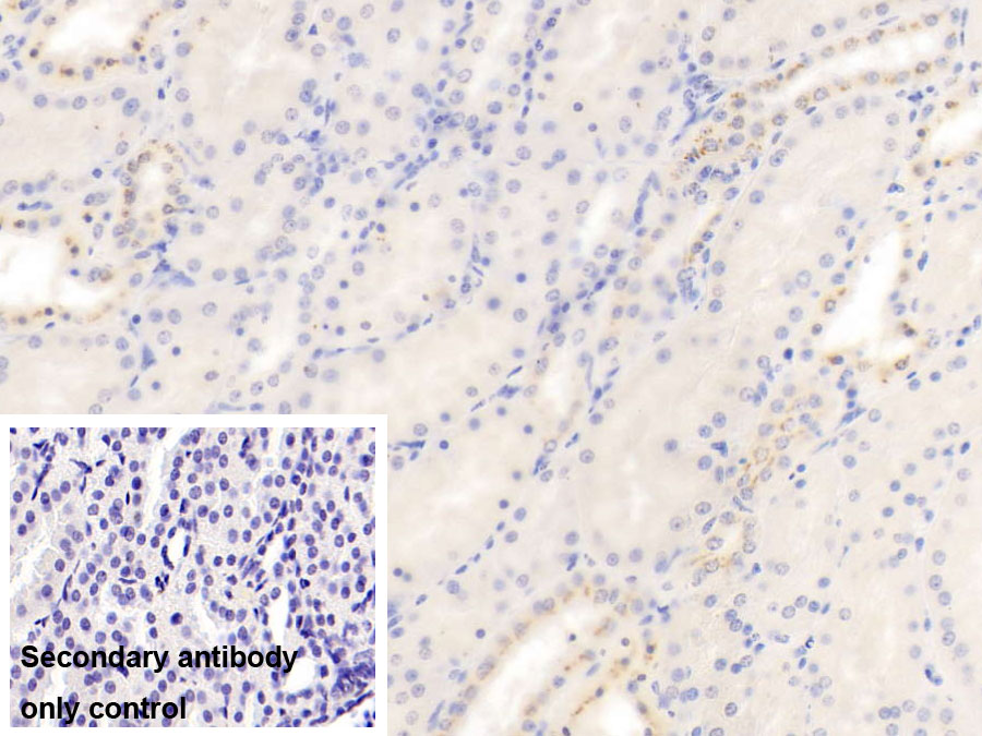 Monoclonal Antibody to Cluster Of Differentiation 40 Ligand (CD40L)