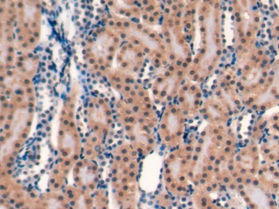 Monoclonal Antibody to Cluster Of Differentiation 40 Ligand (CD40L)