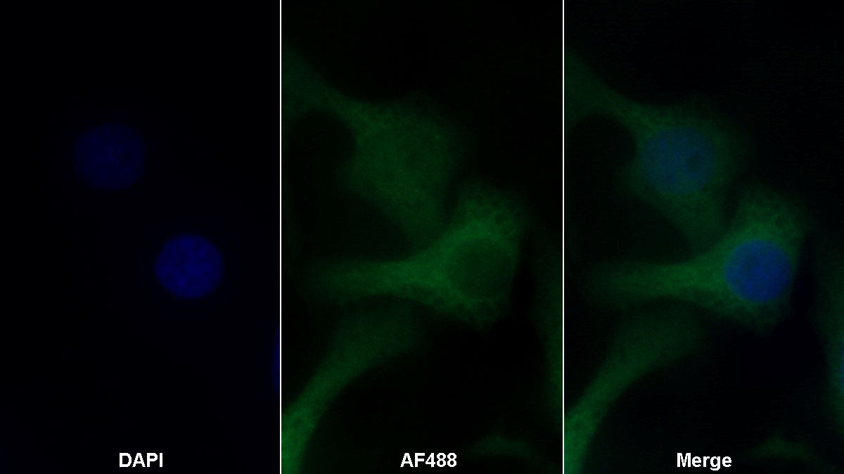 Monoclonal Antibody to Stem Cell Factor Receptor (SCFR)