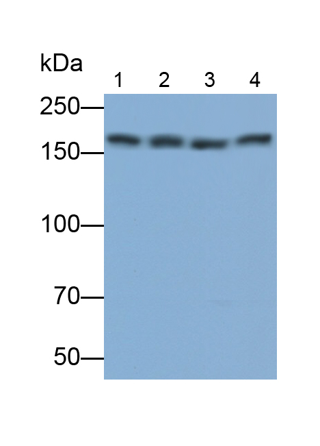 Monoclonal Antibody to Stem Cell Factor Receptor (SCFR)