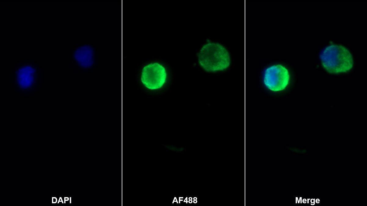 Monoclonal Antibody to Stromal Cell Derived Factor 1 (SDF1)