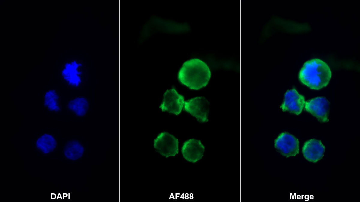 Monoclonal Antibody to Stromal Cell Derived Factor 1 (SDF1)