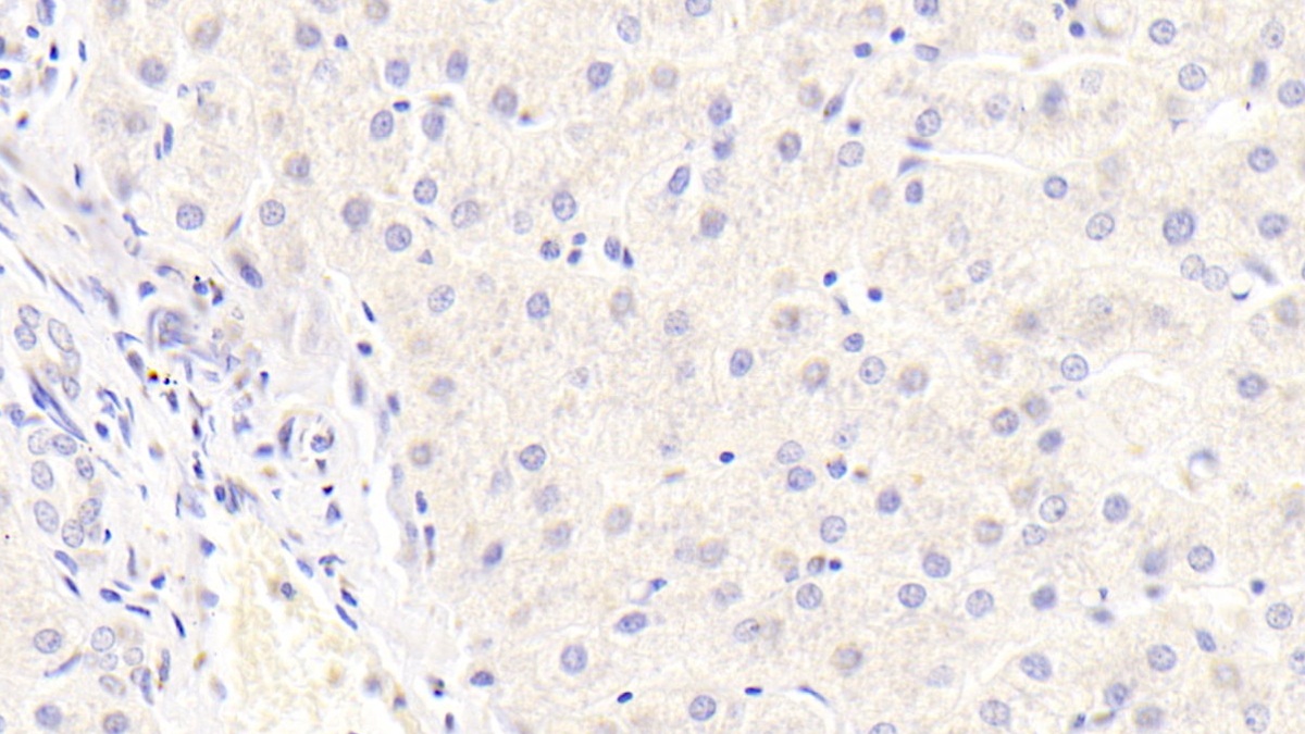 Monoclonal Antibody to Transforming Growth Factor Alpha (TGFa)