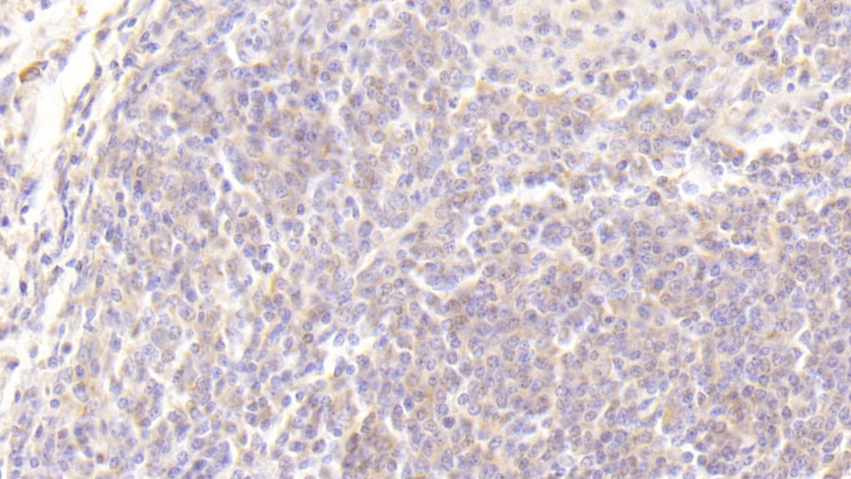 Monoclonal Antibody to Transforming Growth Factor Alpha (TGFa)