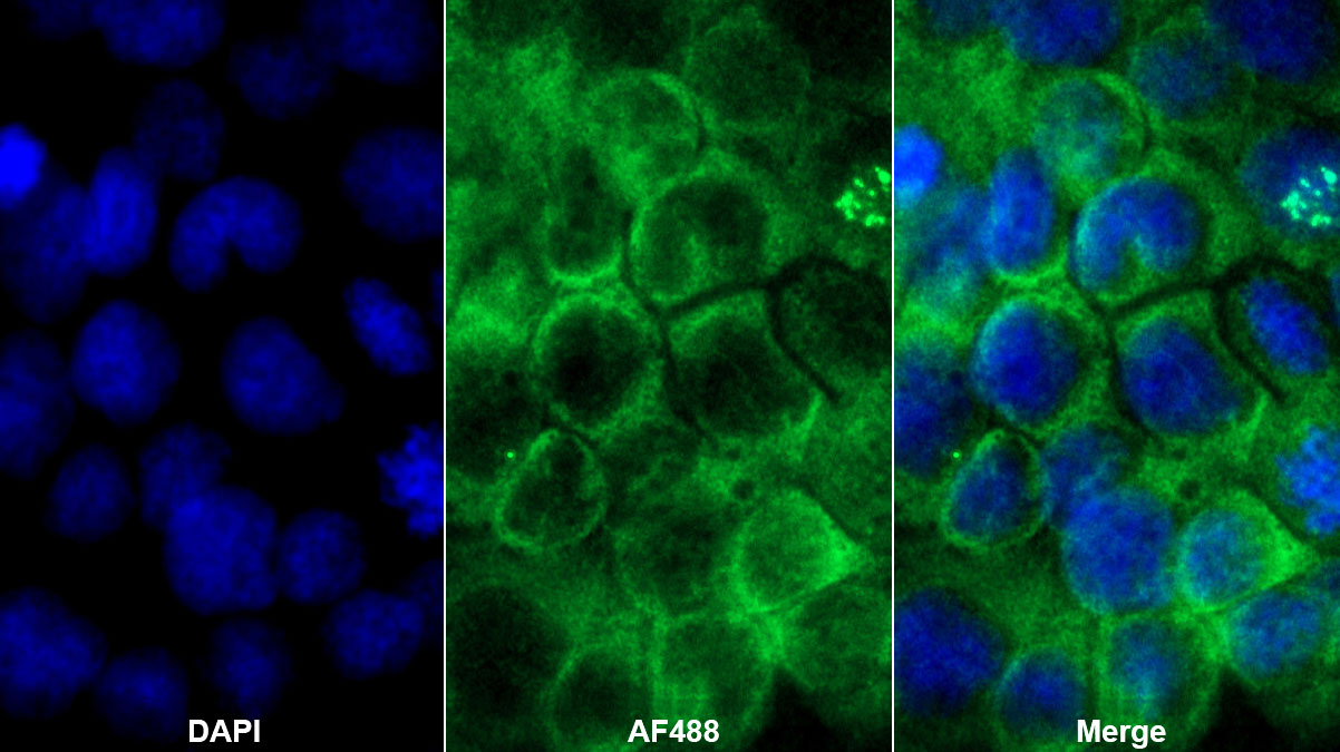 Monoclonal Antibody to Transforming Growth Factor Alpha (TGFa)