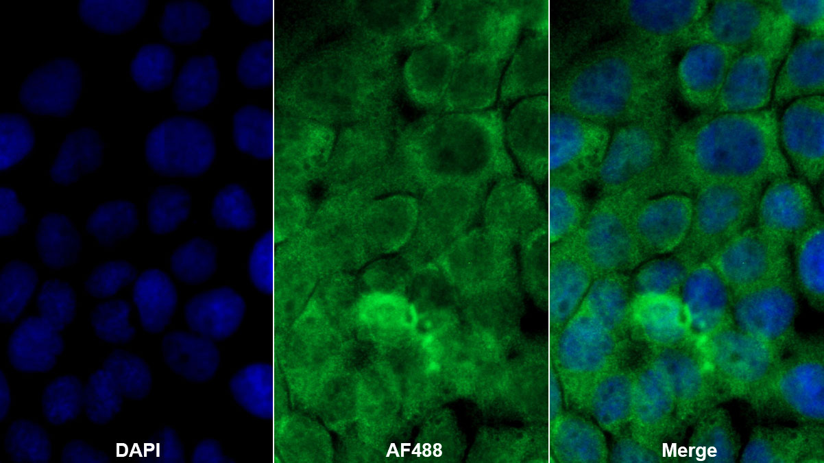 Monoclonal Antibody to Transforming Growth Factor Alpha (TGFa)