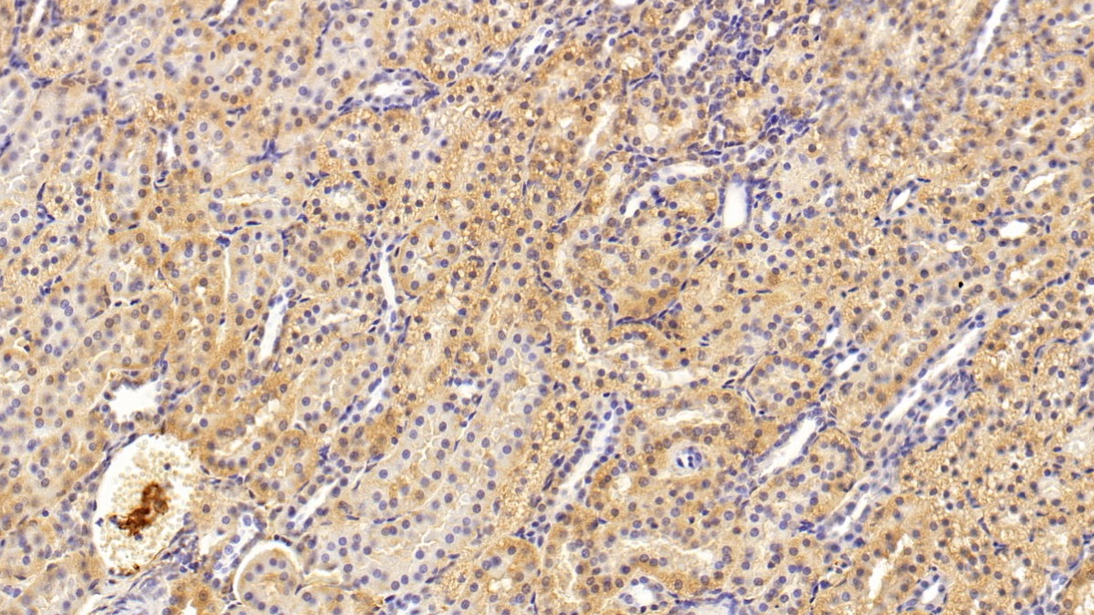 Monoclonal Antibody to Transforming Growth Factor Beta 1 (TGFb1)