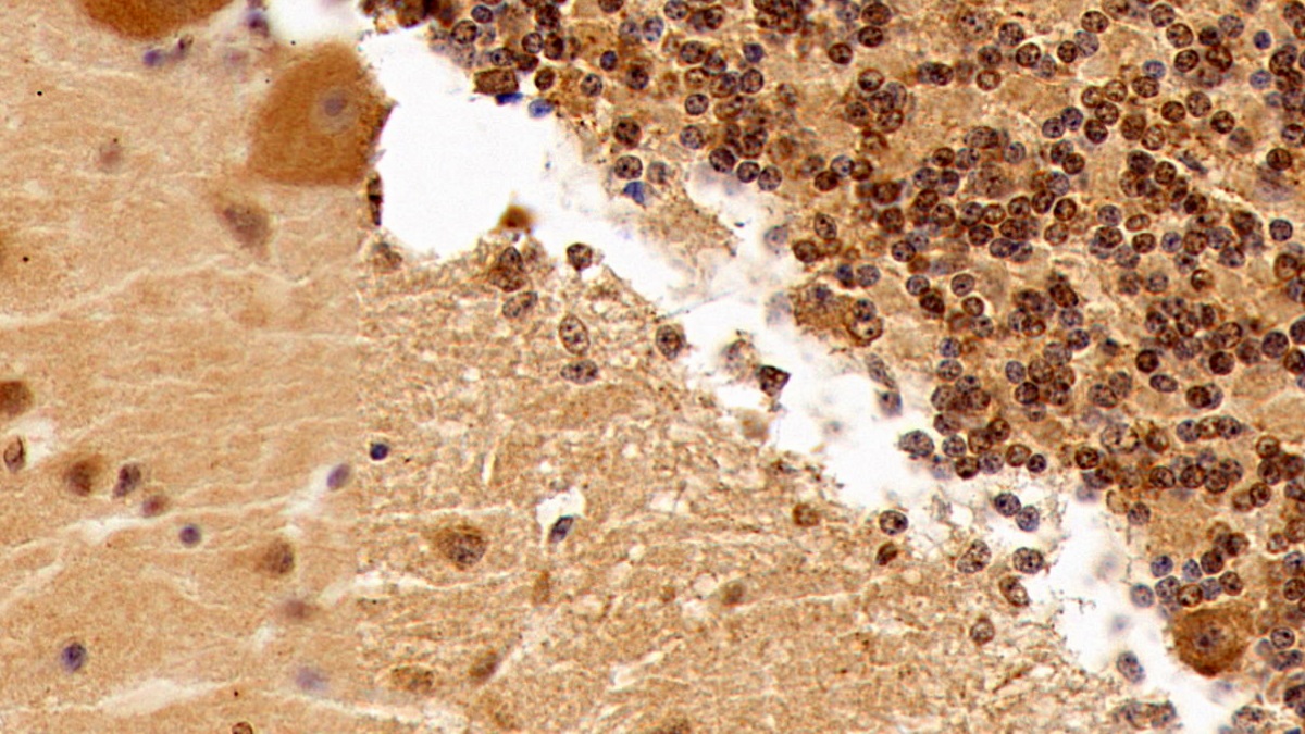 Monoclonal Antibody to Transforming Growth Factor Beta 1 (TGFb1)