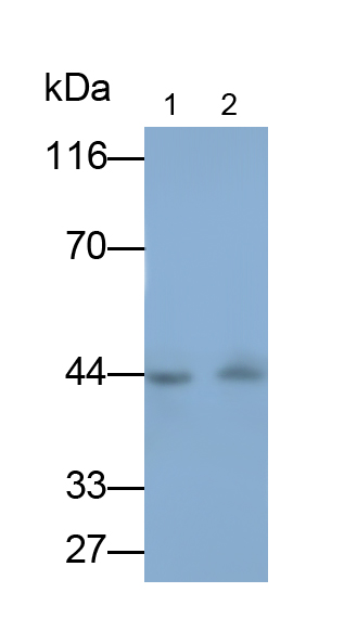 Monoclonal Antibody to Transforming Growth Factor Beta 1 (TGFb1)