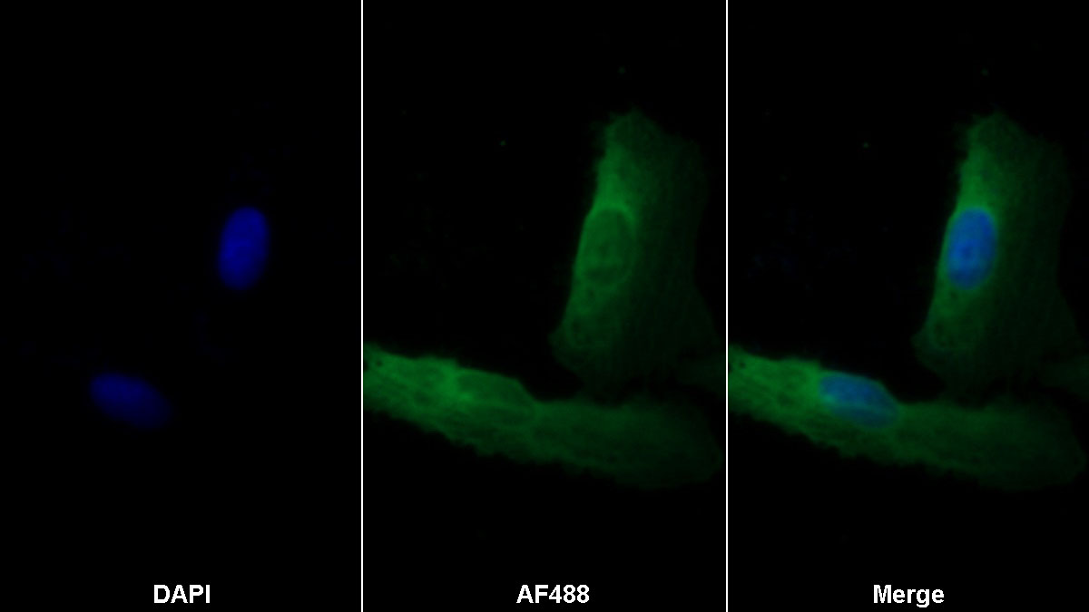 Monoclonal Antibody to Transforming Growth Factor Beta 1 (TGFb1)