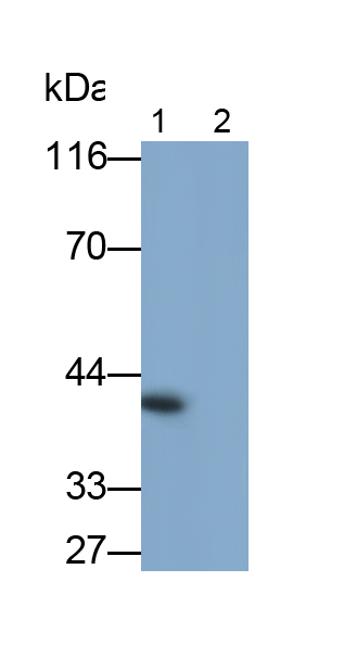 Monoclonal Antibody to Transforming Growth Factor Beta 1 (TGFb1)