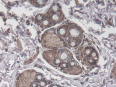 Monoclonal Antibody to Transforming Growth Factor Beta 1 (TGFb1)