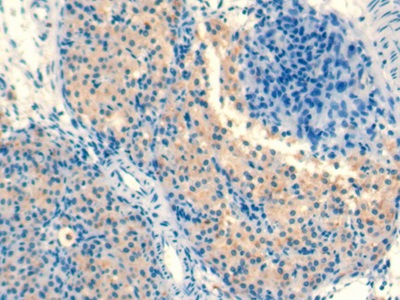 Monoclonal Antibody to Transforming Growth Factor Beta 1 (TGFb1)