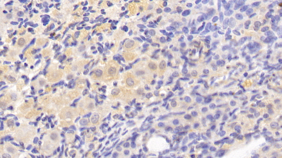 Monoclonal Antibody to Transforming Growth Factor Beta 1 (TGFb1)