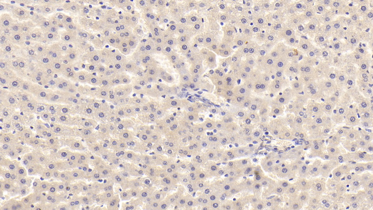 Monoclonal Antibody to Transforming Growth Factor Beta 1 (TGFb1)