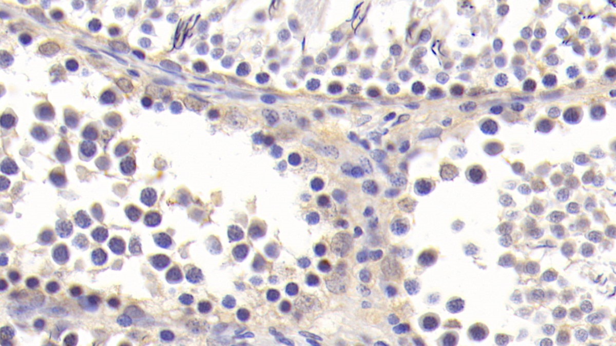 Monoclonal Antibody to Transforming Growth Factor Beta 1 (TGFb1)