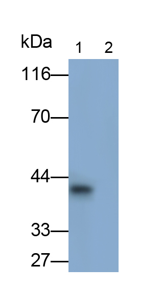 Monoclonal Antibody to Transforming Growth Factor Beta 1 (TGFb1)