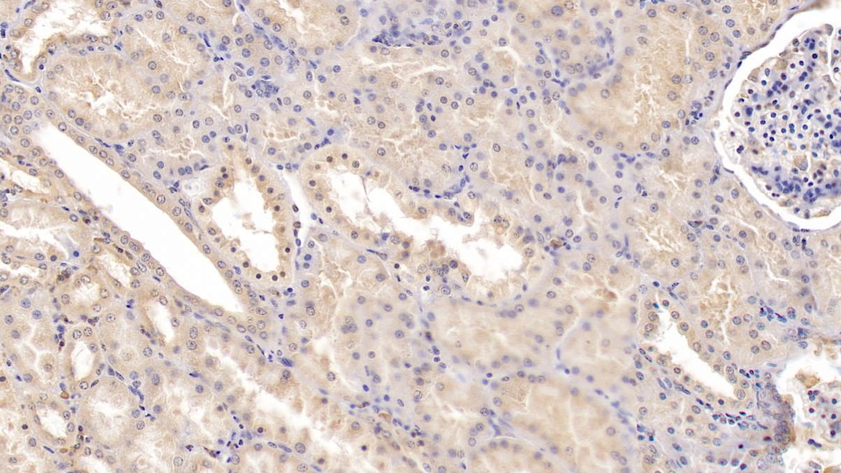 Monoclonal Antibody to Tyrosine Kinase With Immunoglobulin Like And EGF Like Domains Protein 1 (Tie1)