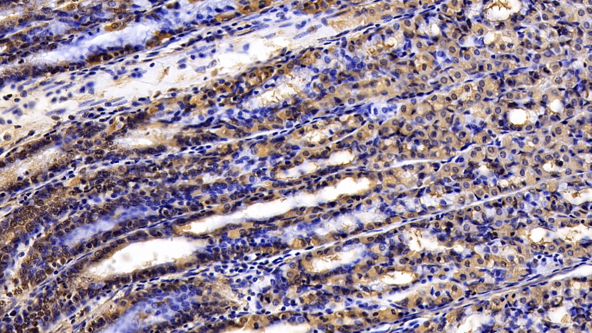 Monoclonal Antibody to Tissue Inhibitors Of Metalloproteinase 3 (TIMP3)