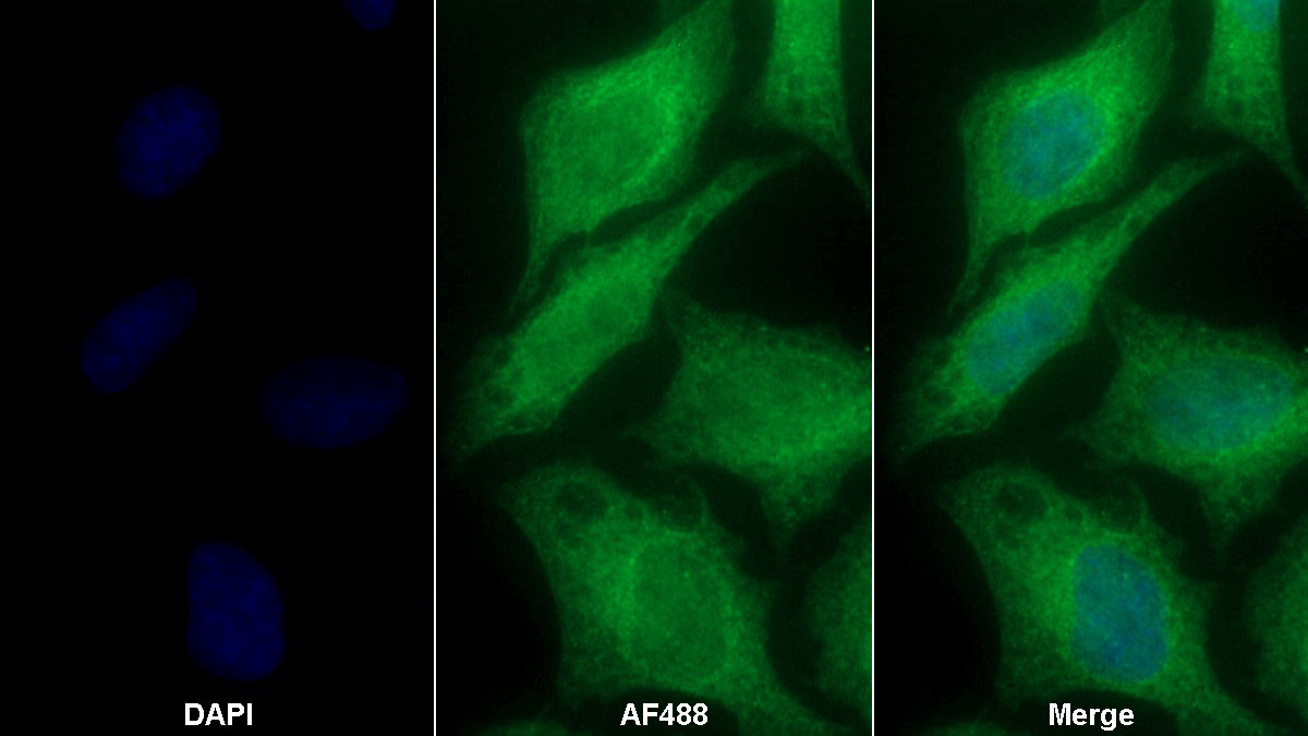 Monoclonal Antibody to Tissue Inhibitors Of Metalloproteinase 3 (TIMP3)