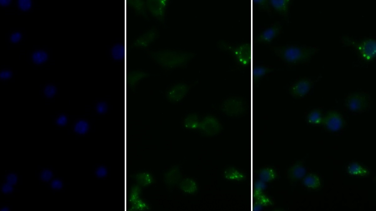 Monoclonal Antibody to Tumor Necrosis Factor Alpha (TNFa)